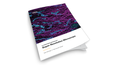 FM-Super-Resolution-Microscopy-E-book-Teaser-bob电竞安全吗BRUKER