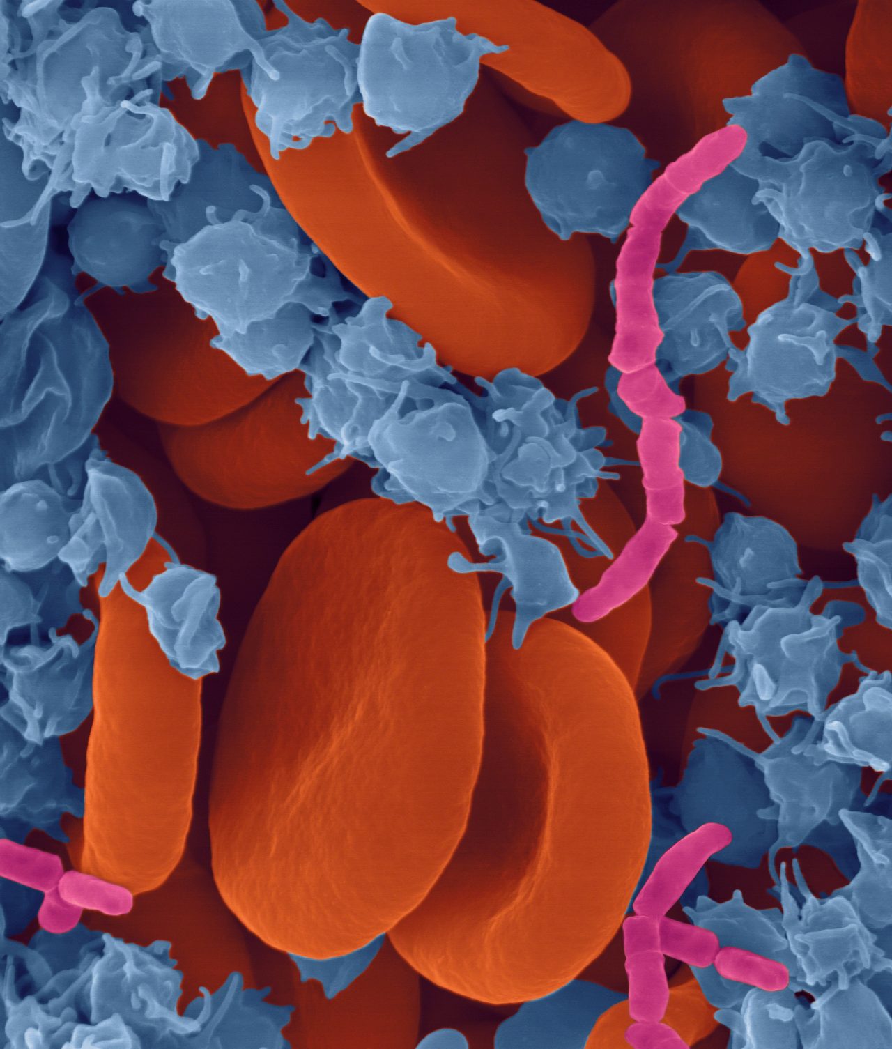 MBTSepsityper®套件US IVD
