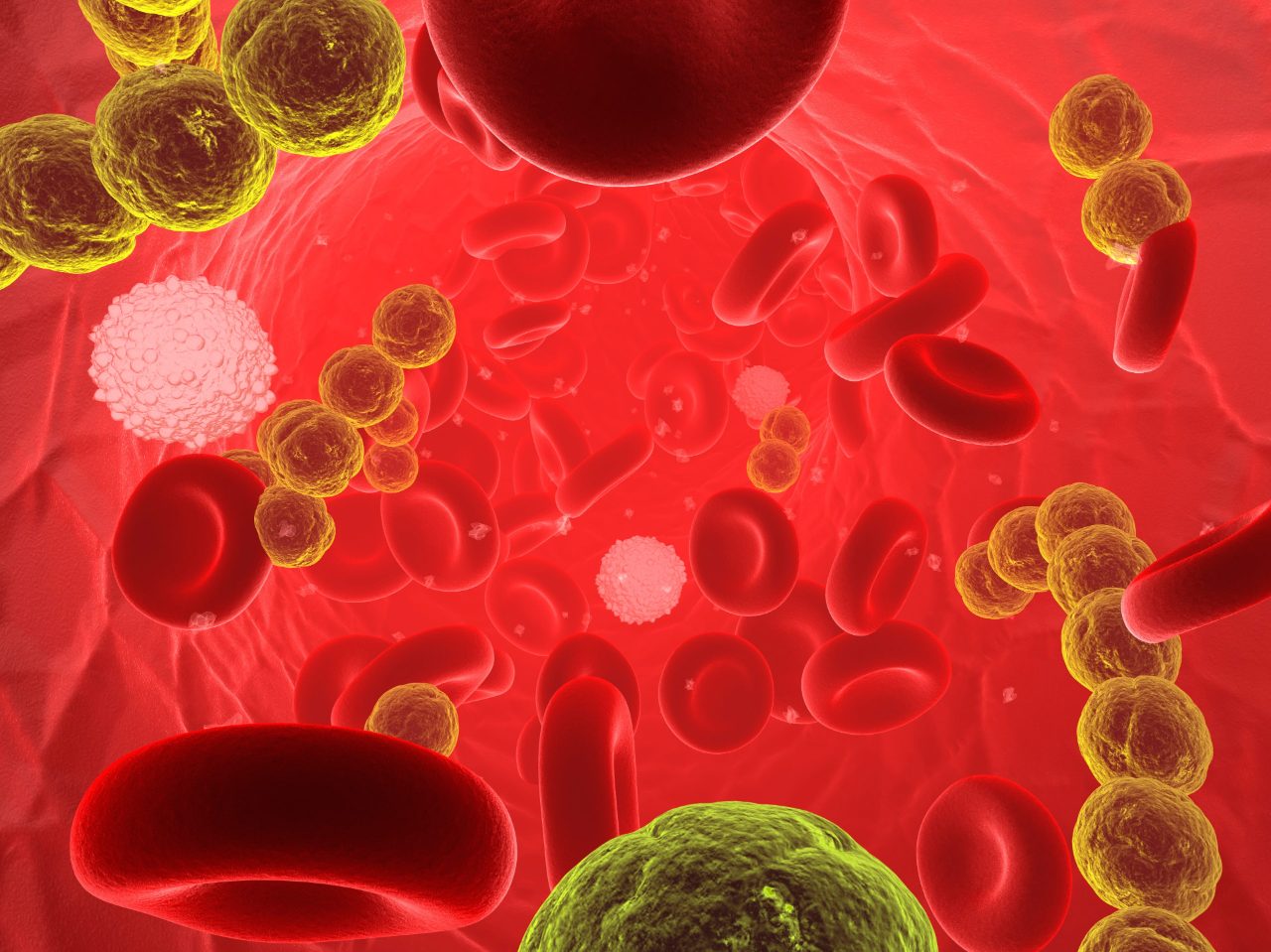 sepsis-and-resistance-testing-banner-bob电竞安全吗bruker