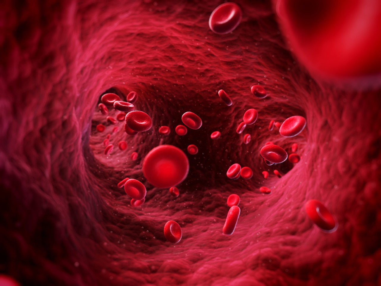 Sepsis sulto-shutterstock-130094258-md-web