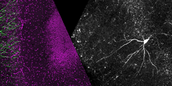 csm_Imaging-Dendritic-and-Somatic-Activity-Underlying-Hippocampal-Place-Coding-in-Familiar-and-Novel-Evironments_0c5265caab