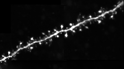 csm_web_banner_a_a_spike-timing_depnedent_plasticity_rule_for_dentritic_spines_e8abec1896