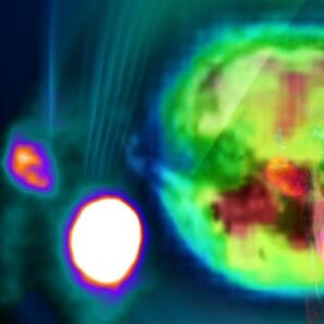 nuc_molecular_imaging