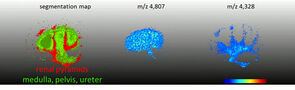 三维可视化与SCiLS实验室,Oetjen et al .,蛋白质组学学报,2013