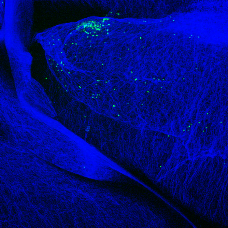 GFP-expressing T细胞(绿色)积累在胰岛鼠标发展中自身免疫性胰腺炎最终导致糖尿病。
