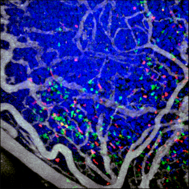 GFP-expressing细胞毒性T淋巴细胞(绿色)和tdTomato-expressing调节性T细胞(红色)浸润小鼠结肠癌癌植入一个背皮肤褶室。肿瘤细胞核(蓝色)通过标记表达式的Cerulean-histone H2B融合蛋白。通过静脉注射血管(白色)突出显示。